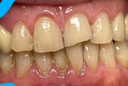 Odontología en General